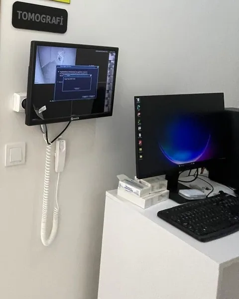 Tomografi biriminin kumanda ünitesi ve ekranı